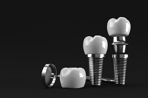 How To Care For Your Dental Implants